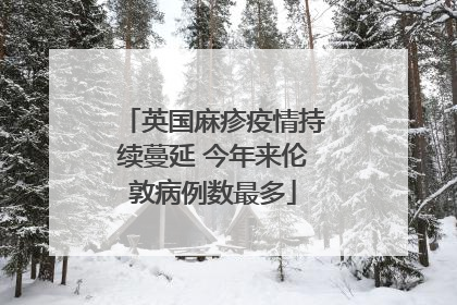 英国麻疹疫情持续蔓延 今年来伦敦病例数最多